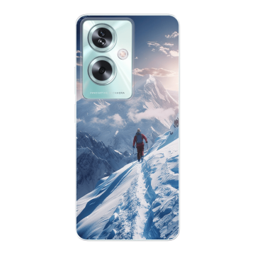 Oppo A79 - Lav dit eget Soft Cover